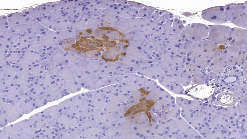 IHC_Insulin / Diabetes